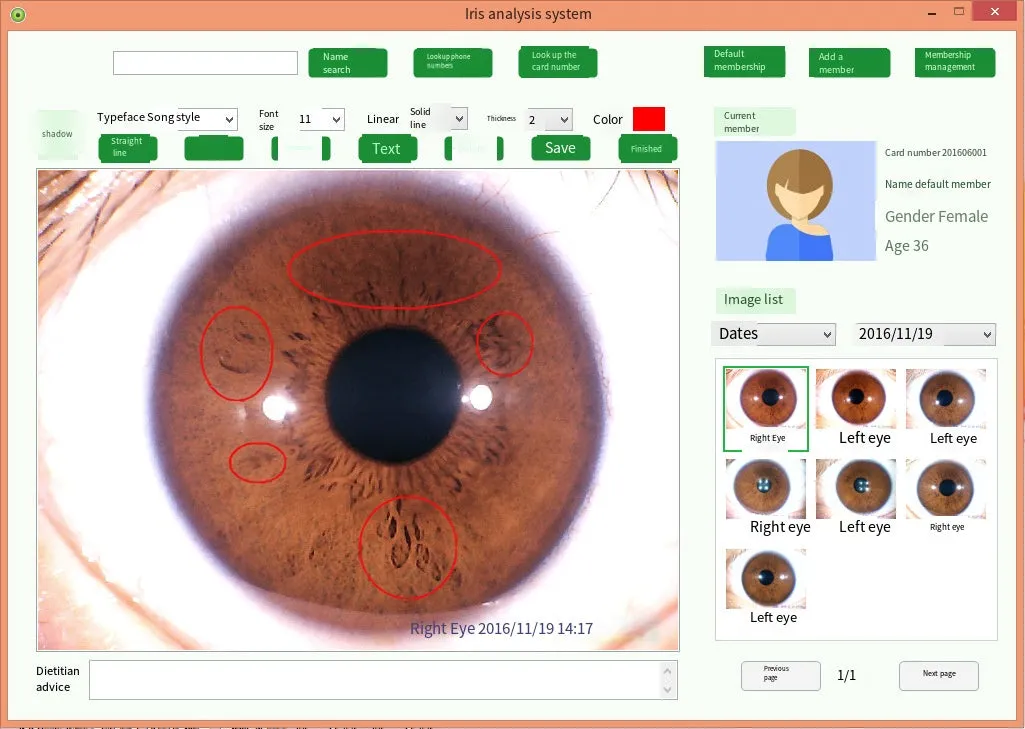 Iridology Analysis Iris Analyzer Iriscope Digital Iridology Camera