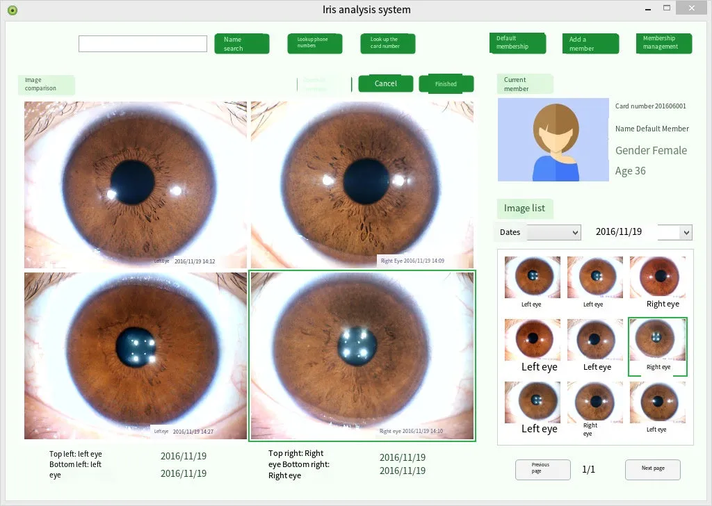 Iridology Analysis Iris Analyzer Iriscope Digital Iridology Camera