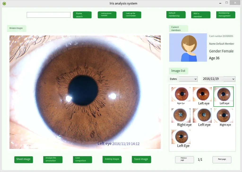 Iridology Analysis Iris Analyzer Iriscope Digital Iridology Camera