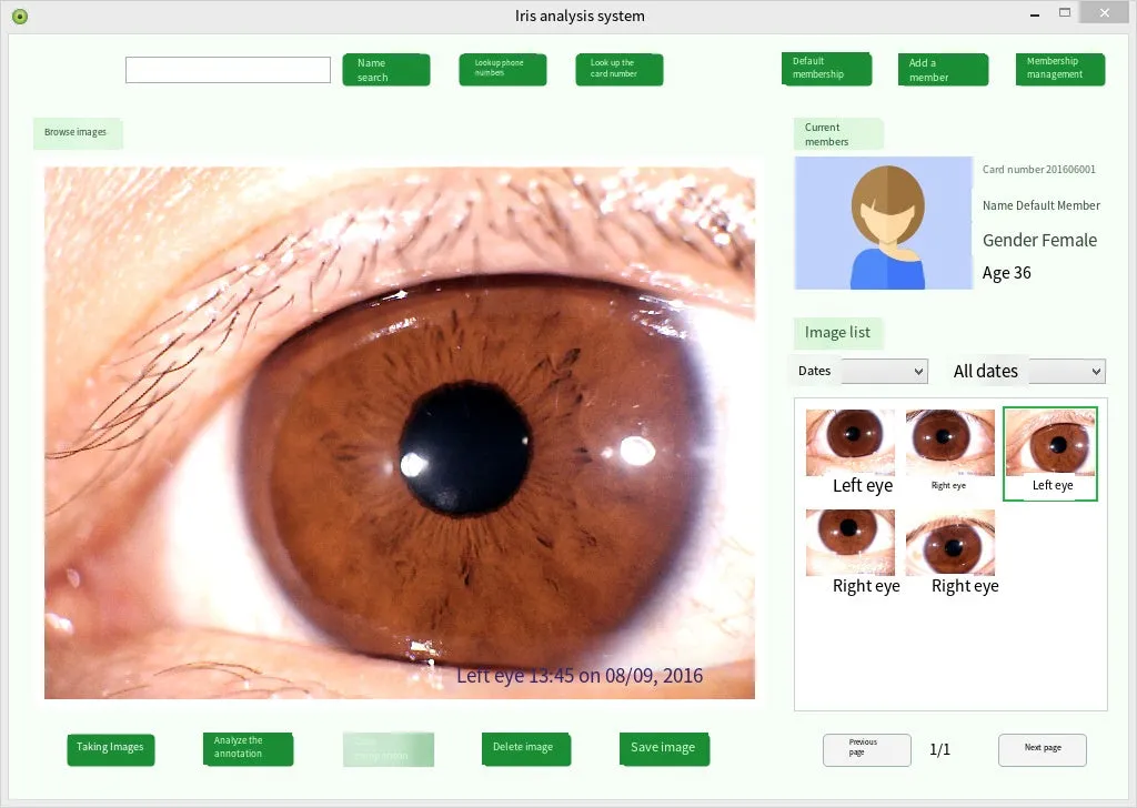 Iridology Analysis Iris Analyzer Iriscope Digital Iridology Camera