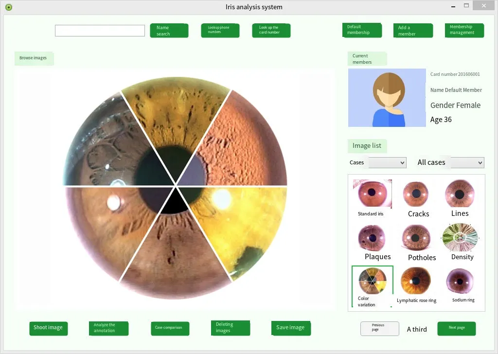 Iridology Analysis Iris Analyzer Iriscope Digital Iridology Camera