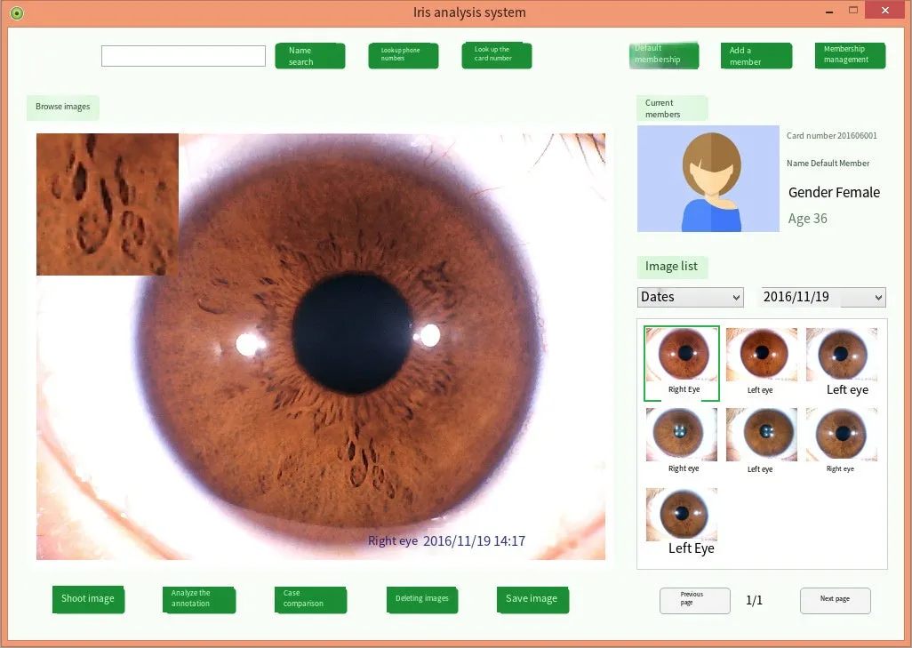 Iridology Analysis Iris Analyzer Iriscope Digital Iridology Camera